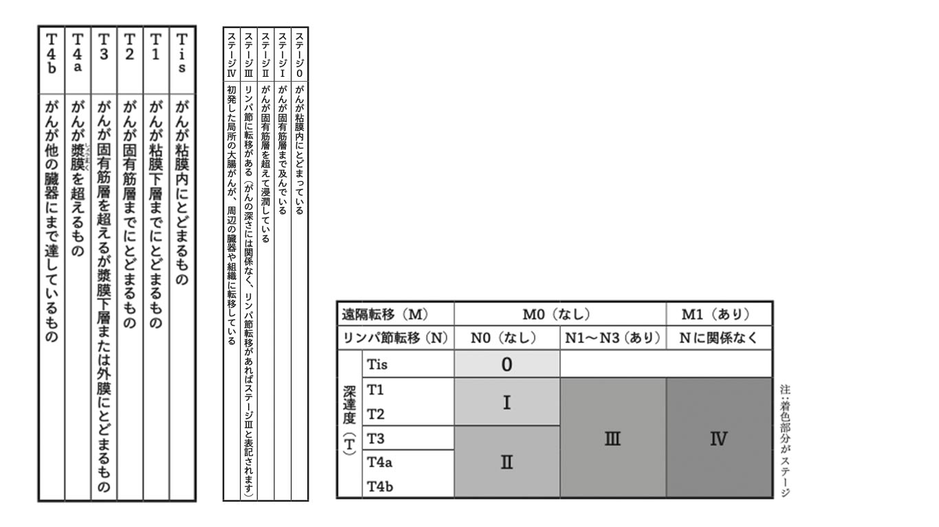 ステージ分類